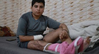 İsrail'in geride bıraktığı mühimmatla engelli kalan Gazzeli Muhammed: 'Başka çocuklar benim gibi olmasın'