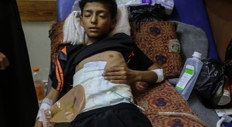 İsrail saldırısında ağır yaralanan 13 yaşındaki Ali, tedavi için Gazze'den tahliye edilmeyi bekliyor