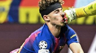 Atletico Madrid-Barcelona maçında yürekleri ağza getiren sakatlık