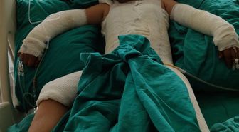 Trafoya takılan uçurtmasını almak isterken akıma kapılan çocuk ağır yaralandı; babadan ihmal iddiası