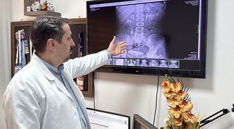 İdrar kanalından çıkan 51 taş, doktorları bile şaşkına çevirdi