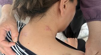 Eşinin saldırdığı kadın 17 bıçak darbesi aldı, ölü numarasıyla kurtuldu