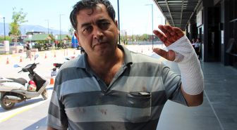 İstanbul İl Sağlık Müdürü Güner: Kurban kesimi sırasında 767 kişi yaralandı