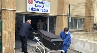 Sivas'ta KKKA hastalığı şüphesiyle tedavi gören kişi hayatını kaybetti