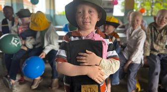 Türk STK'ler Tanzanya'daki albino çocuklara bayram sevinci yaşattı
