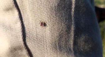 Keneye karşı uyarırken bile üzerinde kene gezdi