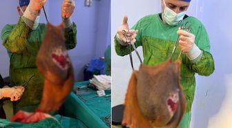 Bu kitle bir insanın karnından çıktı! Doktor tek başına kaldıramadı