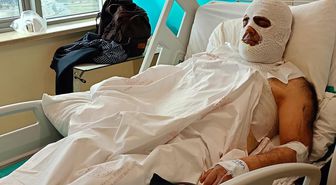 Yüksek gerilim akımına kapılan işçi 42 gündür hastanede