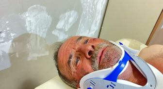 Ayının Saldırısına Nacakla Karşılık Verdi, Yaralı Kurtuldu