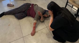 Saldırgan köpek kadının kolunu kopardı