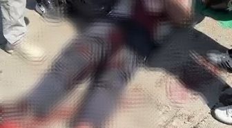 'Park yeri' kavgasında boynundan bıçaklanan baba, göğsünden yaralanan oğluna tampon yaptı