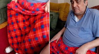 Ünlü şarkıcı Ömer Danış'tan üzen haber: Ayak parmakları kesildi
