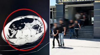 Batman’da akıllara durgunluk veren olay: Yolcu otobüsünde yakalanan 4 şüphelinin midesinden kilo kilo uyuşturucu çıktı