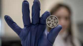 Üniversitede üretilen kişiye özel implantlar hastalara konfor sağlıyor