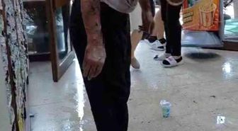 Bursa'da lavaboyu açmak için dökülen kimyasal madde patladı: 2 yaralı
