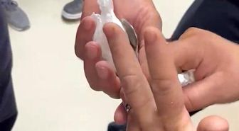 Yüzüğü parmağına sıkışan kadının yardımına itfaiye koştu