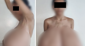 13 yaşında başladı! Göğüsleri vücut ağırlığının dörtte birine ulaştı
