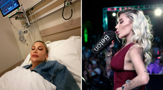 İrem Derici’nin çene görüntüsü şaşırttı! Herkes dolgu sandı ama gerçek ortaya çıktı