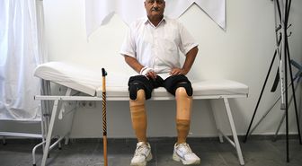 Diyabet hastası protezlerle yeniden yürüyor