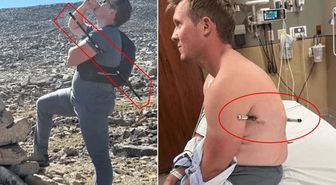 Mucize kurtuluş! Bu halde 16 kilometre yürüdü