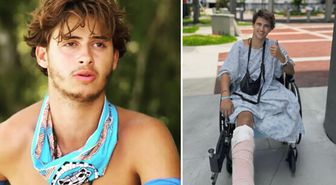 Survivor'da bacağını kaybeden yarışmacıdan yeni paylaşım: Yeni hayatına alışmaya çalışıyor
