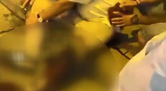 Pitbull saldırısı kavgaya dönüştü: Köpek sahibi 3 yerinden bıçaklandı