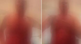 Canlı yayında bıçakla kendine zarar veren fenomen hastaneye kaldırıldı