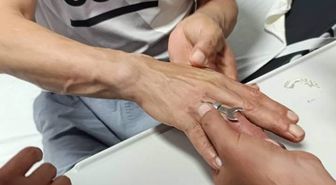 Hatay'da Parmağa Sıkışan Yüzük İtfaiye Tarafından Kesilerek Çıkarıldı