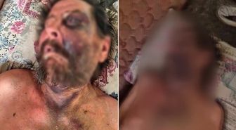 Akılalmaz vahşet! Cenazeye gelmedi diye bu hale getirdi