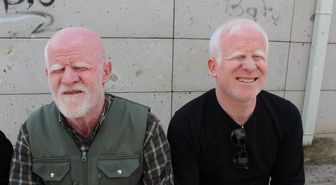 Albino Gökhan Uygur: Engeline Rağmen Ailesinin Geçimini Sağlıyor