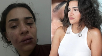 Eski sevgili, uzaklaştırma kararını hiçe sayıp dehşet saçtı! Ebru hemşirenin sesini duyun