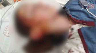 Köpek Saldırısında 1.2 Milyon TL Tazminat