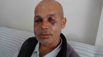 Engelli adama saldıran şüpheli serbest