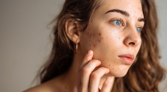 Ergenlerde 'cam gibi cilt' takıntısı büyüyor! Uzmanlar uyardı: Serum ve asit yığmak cildi bozuyor, 3 ürün yeterli
