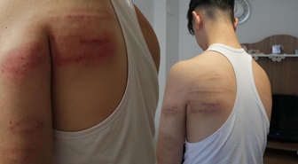 15 yaşındaki berber çırağına akılalmaz işkence! Demir sopayla dövüp tuvalete kilitlediler