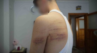 Niğde'de çırağını darp ettiği iddiasıyla gözaltına alınan işletme sahibi tutuklandı