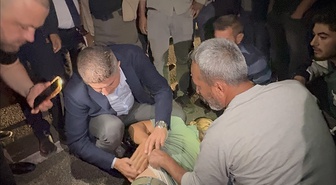 Adıyaman'da aracın çarptığı yaya yaralandı, AK Partili vekil Şan ilk müdahaleyi yaptı