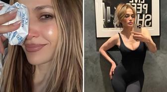 Jennifer Lopez, Amerikan Müzik Ödülleri provaları sırasında yüzünden yaralandı