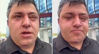 Vahim iddia: Altındağ Belediye Başkanı Tiryaki belediye işçisini darp etti