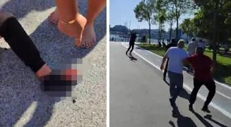 Galatasaraylı taraftar Kadıköy'de silahlı saldırıya uğradı! Sarı-kırmızılılardan açıklama