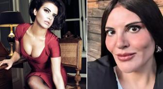 Güzel şarkıcıdan 'estetik' iddialarına videolu yanıt: Tanımıyorum
