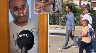 Çocuklarının gözü önünde dövülen baba sessizliğini bozdu