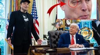Elon Musk'ın gözüne ne oldu? Basın toplantısının önüne geçen fotoğraf