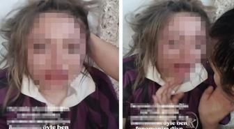 Genç kızı darp edip özür dilettiler, o anları sosyal medyada paylaştılar