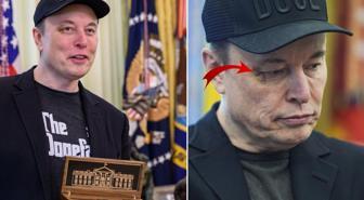 Elon Musk'ın gözündeki morlukla ilgili bomba iddia