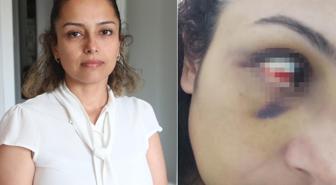 Burcu öğretmenin yardım çığlığı: Kurtarın beni