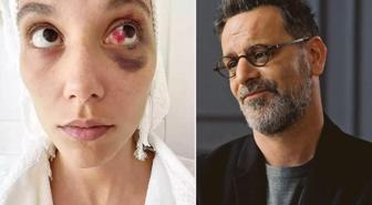 Ozan Güven'e 'kasten yaralama' suçundan hapis cezası
