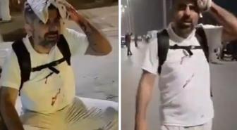 Gazze için yürüyenlere Mısır'da müdahale! HÜDA Par Milletvekili başından yaralandı