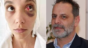 Ozan Güven'e 'kasten yaralama' suçundan hapis cezası