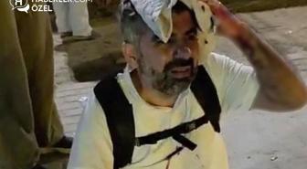 Mısır'da saldırıya uğrayan HÜDA PAR'lı Dinç, yaşadıklarını Haberler.com'a anlattı